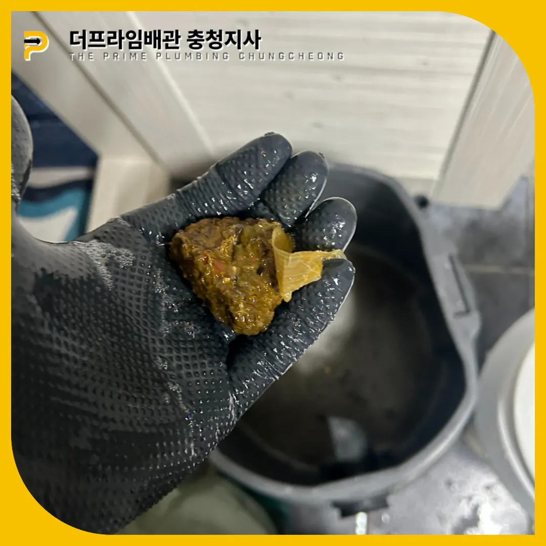 대변막힘