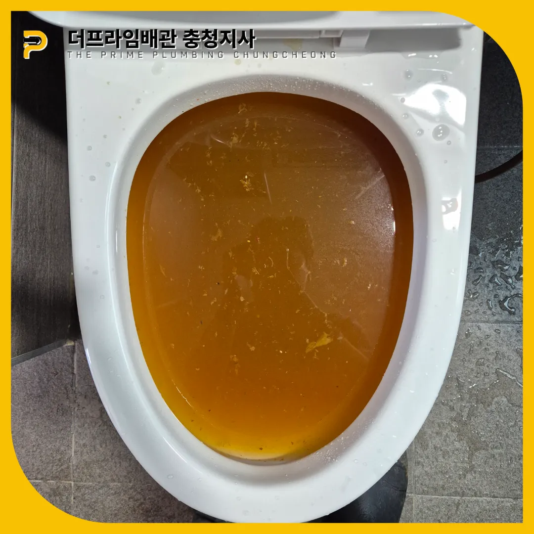 대변막힘